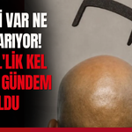 Ne dişi var ne saç tarıyor! 280 TL'lik kel tarağı gündem oldu