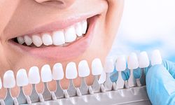 Diş beyazlatma işlemi diş hekimi tarafından yapılmalı