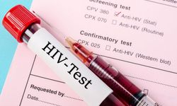 AIDS, enfeksiyonun yayılmasını engellemenin önemli!