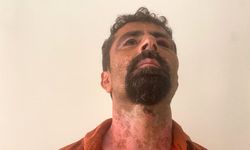Öfkeli damat kayınpederini hastanelik etti