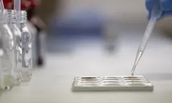 Ünlü isimlerin laboratuvar sonuçları dosyaya girdi