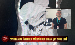 Zayıflamak isterken midesinden çıkan şey şoke etti