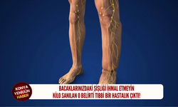 Bacaklarınızdaki şişliği ihmal etmeyin: Kilo sanılan o belirti tıbbi bir hastalık çıktı!