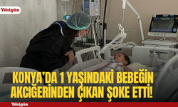 Konya’da 1 yaşındaki bebeğin akciğerinden çıkan ceviz şoke etti!
