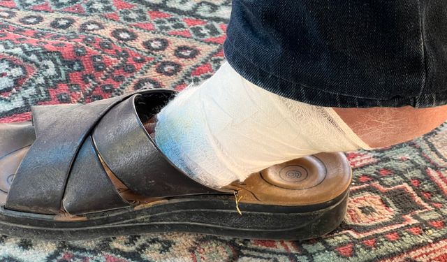 Kesilecek denen ayağı merhemle iyileşti
