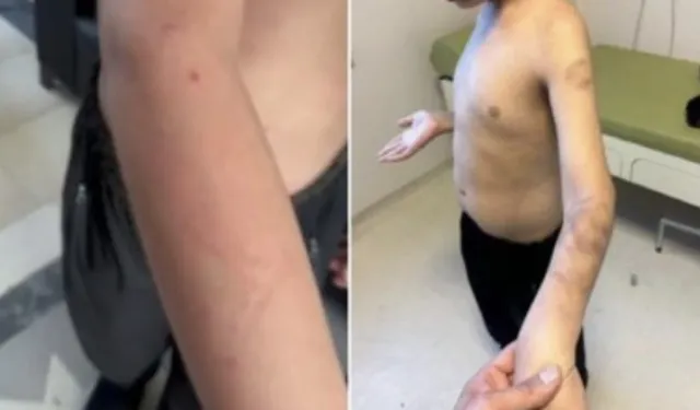 Otizmli çocuğunu darbettiği iddia edilen babaya hapis cezası