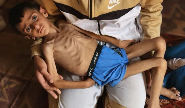 Gazze'de Çocuk Olmak! Küçük Osama yaşam mücadelesi veriyor