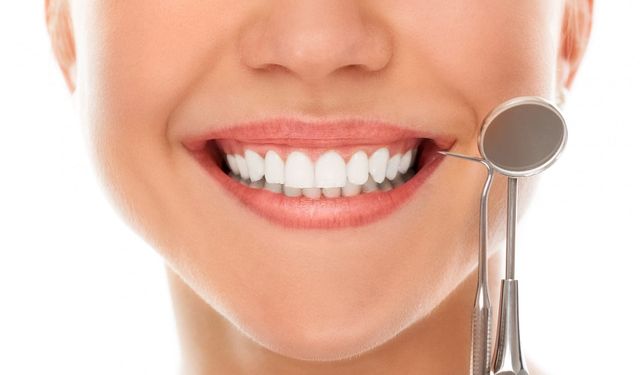 Hollywood Smile nedir?