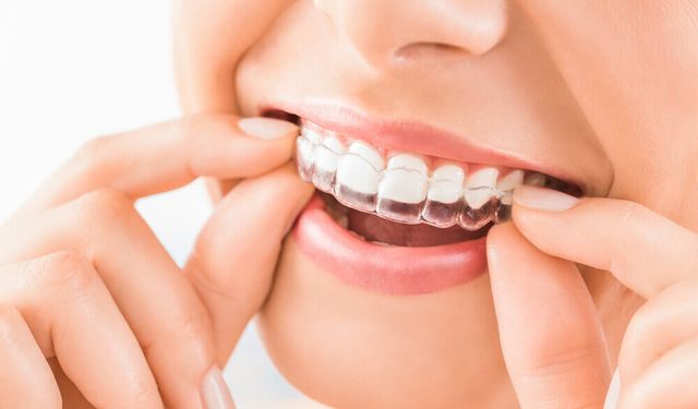 Ortodonti nedir ve ne işe yarar?