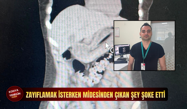 Zayıflamak isterken midesinden çıkan şey şoke etti