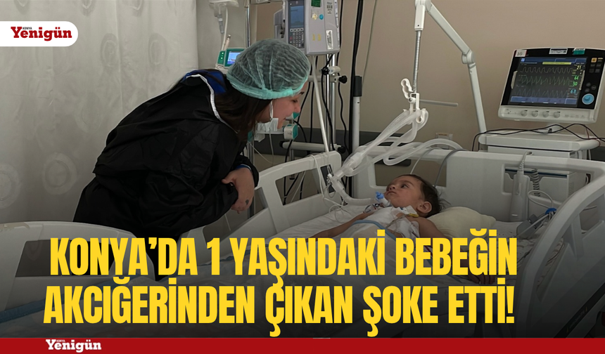 Konya’da 1 yaşındaki bebeğin akciğerinden çıkan ceviz şoke etti!